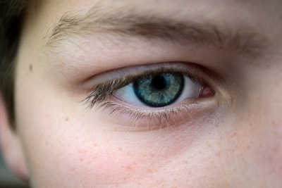 ojeras